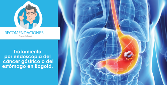 Gastroenterólogo especialista en cáncer de estómago Bogotá
