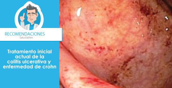 Tratamiento inicial actual de la colitis ulcerativa y enfermedad de crohn