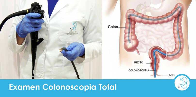 Examen de Colonoscopia total con sedación Bogotá