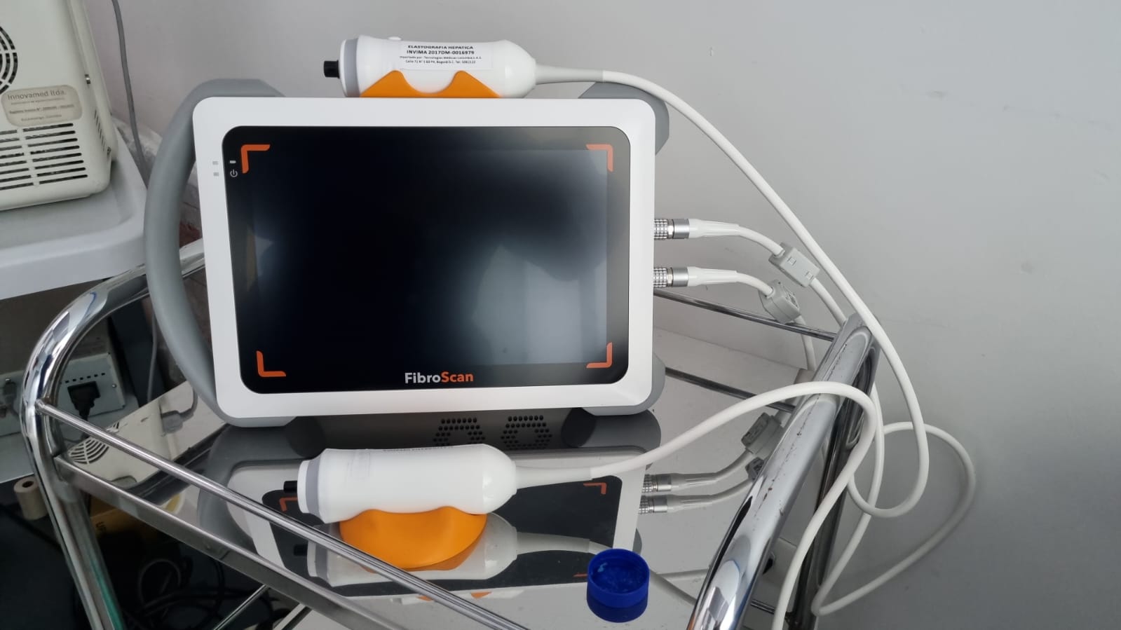 equipo elastografía hepática serviendoscopias