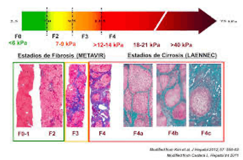 lectura equipo elastografía hepática serviendoscopias
